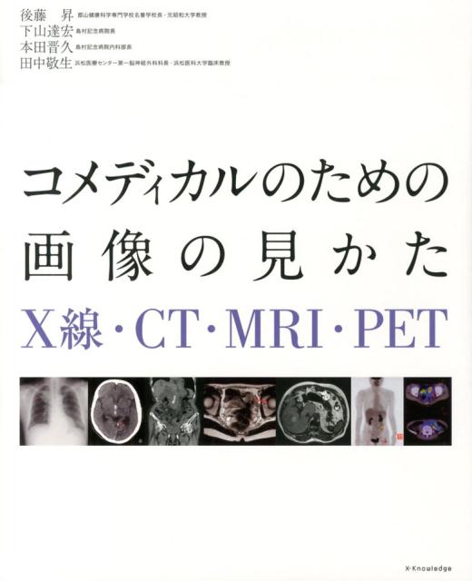 コメディカルのための画像の見かた X線・CT・MRI・PET [ 後藤昇 ]