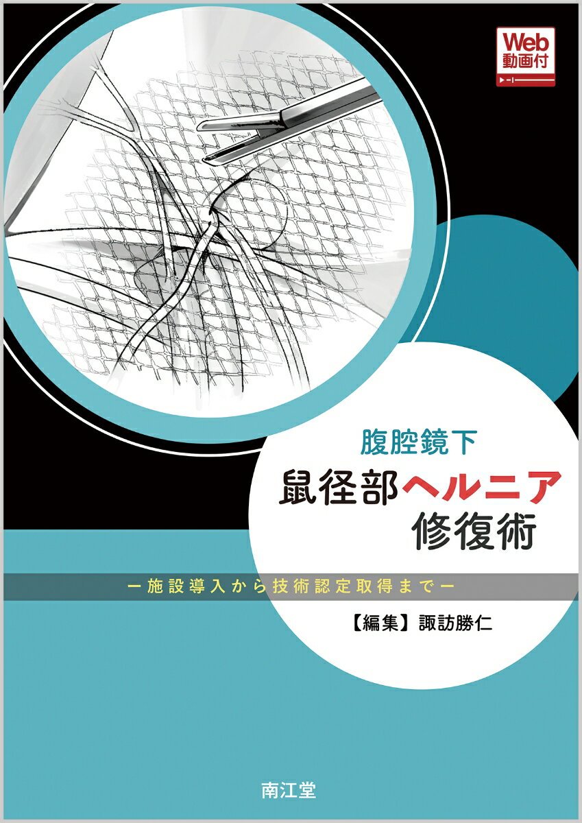 腹腔鏡下鼠径部ヘルニア修復術