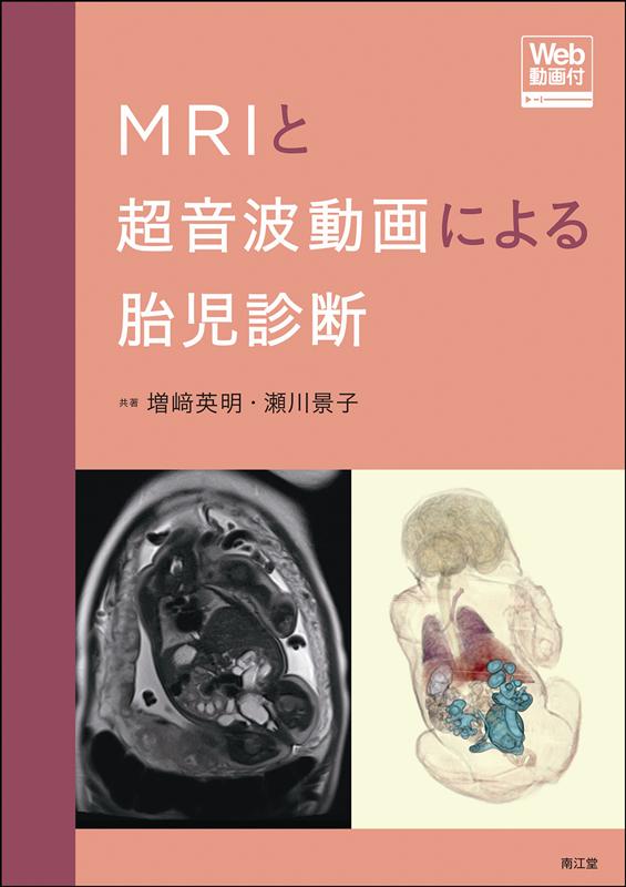 MRIと超音波動画による胎児診断［Web動画付］