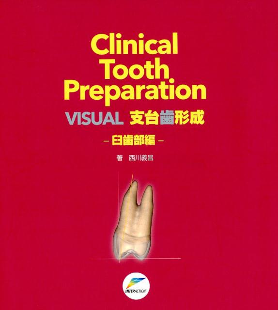 VISUAL支台歯形成ー臼歯部編 （Clinical　Tooth　Preparation） 