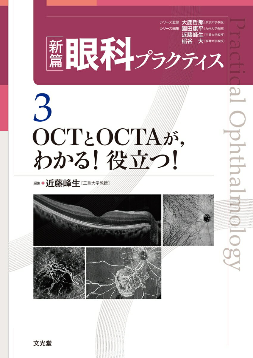 OCTとOCTAが，わかる！役立つ！ （新篇眼科プラクティス 3） 近藤峰生