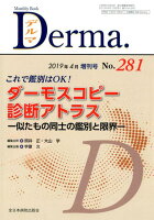 Derma．（No．281（2019年4月増）