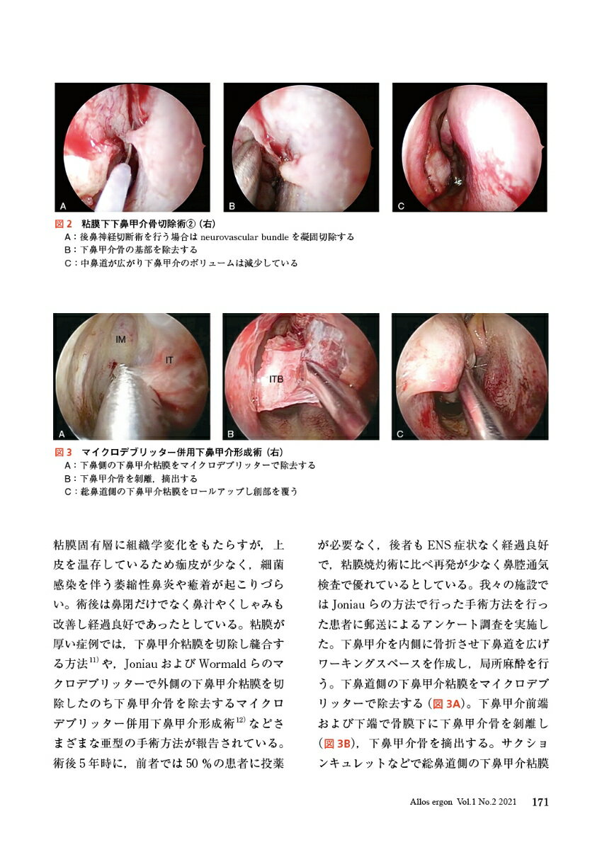 アロスエルゴン Vol.1 No.2　アレルギー性鼻炎に対する外科的治療の可能性と限界 [...
