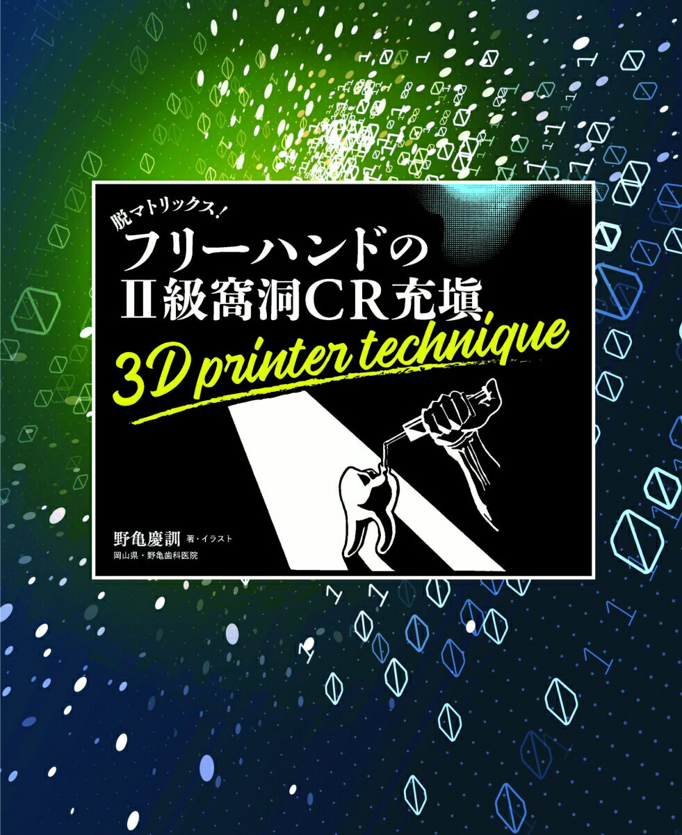脱マトリックス! フリーハンドの2級窩洞CR充塡
