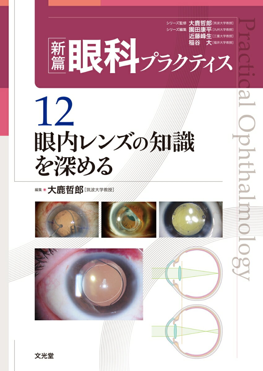 眼内レンズの知識を深める (新篇眼科プラクティス 12)