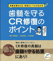 歯髄を守るCR修復のポイント