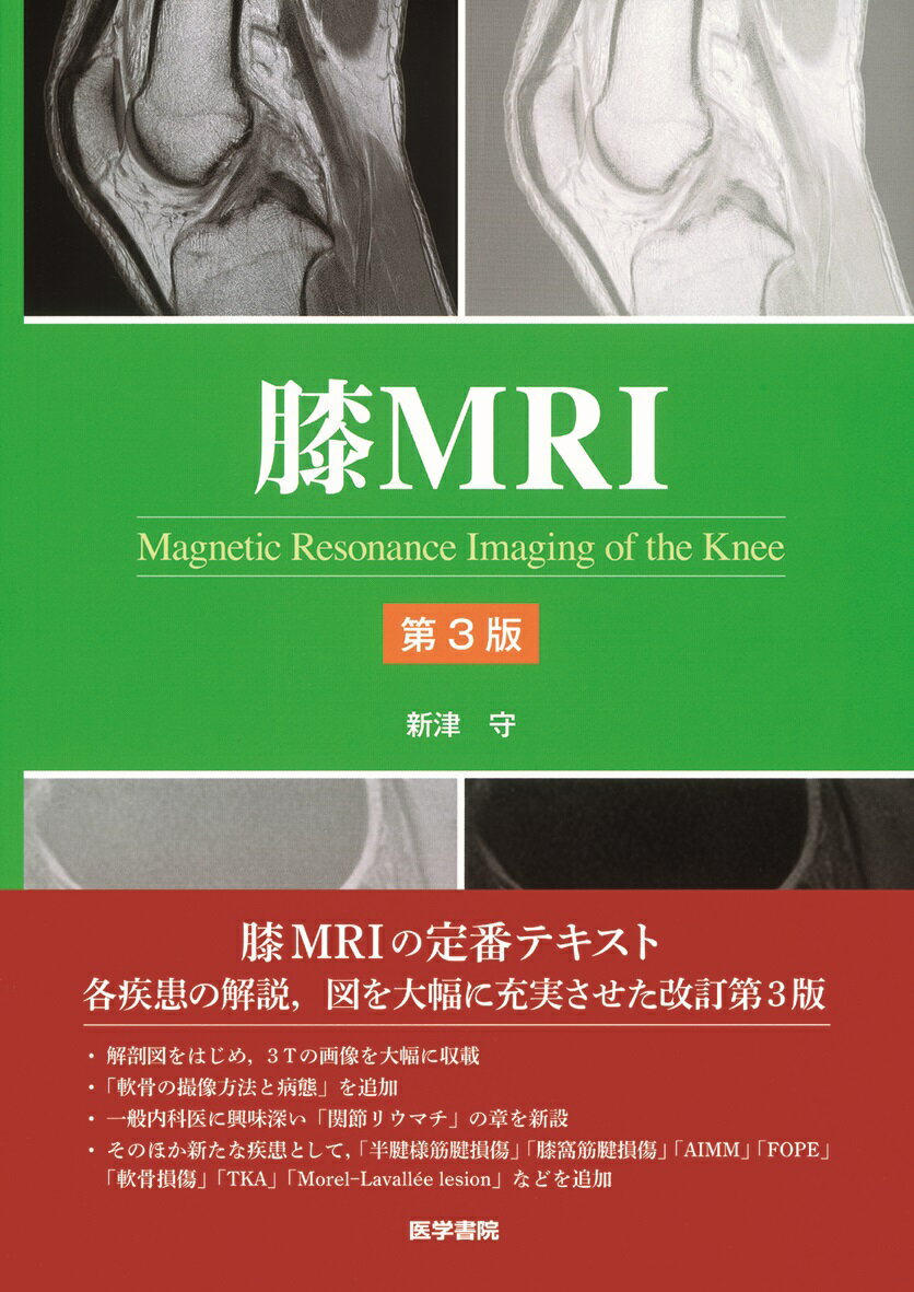 膝MRI 第3版