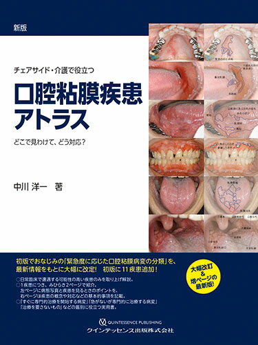 新版　チェアサイド・介護で役立つ　口腔粘膜疾患アトラス