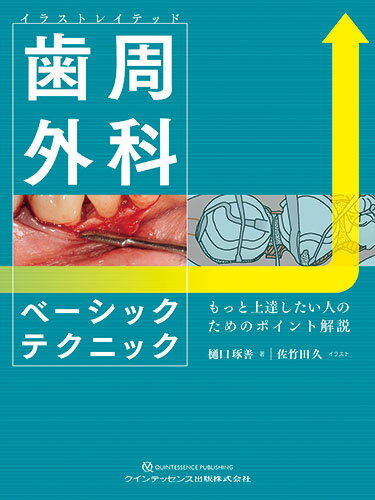 イラストレイテッド　歯周外科ベーシックテクニック もっと上達したい人のためのポイント解説 [ 樋口琢善 ]