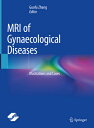 MRI of Gynaecological Diseases: Illustrations and Cases MRI OF GYNAECOLOGICAL DI...