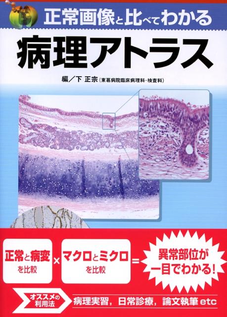 正常画像と比べてわかる病理アトラス