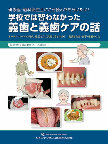 研修医・歯科衛生士にこそ読んでもらいたい！ 学校では習わなかった義歯と義歯ケアの話