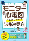 モニター心電図　これならわかる波形の見方 [ 吉野　秀朗 ]