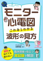 モニター心電図　これならわかる波形の見方 [ 吉野　秀朗 ]