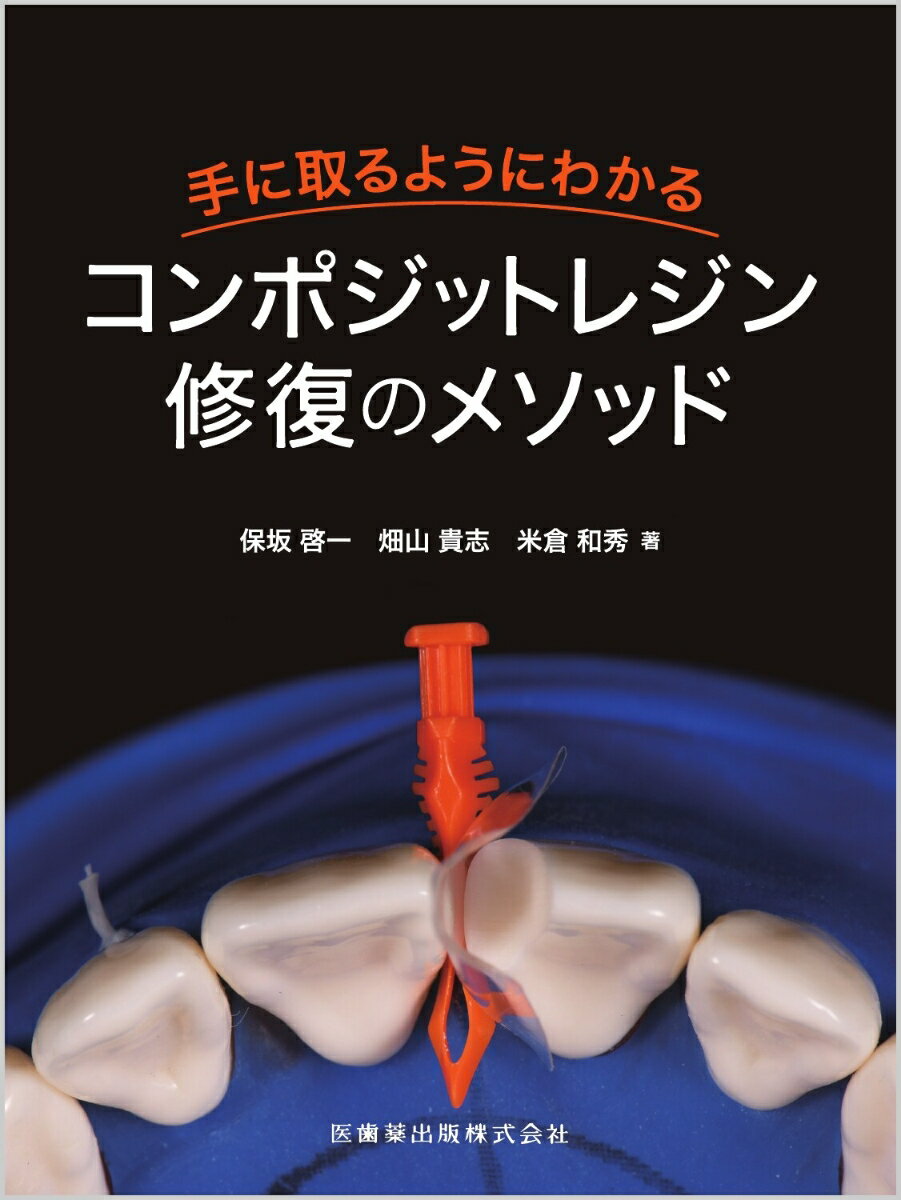 手に取るようにわかるコンポジットレジン修復のメソッド