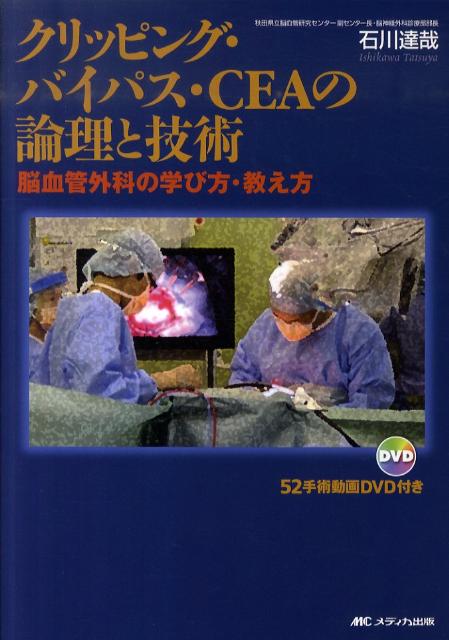 クリッピング・バイパス・CEAの論理と技術