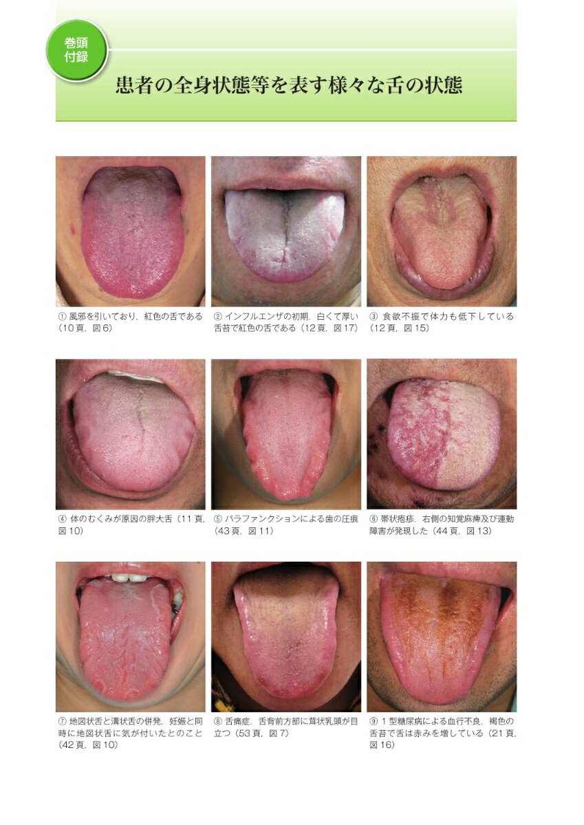 舌の診かた 舌の状態から全身疾患や体の歪みに気づく [ 小山 浩一郎 ] 2