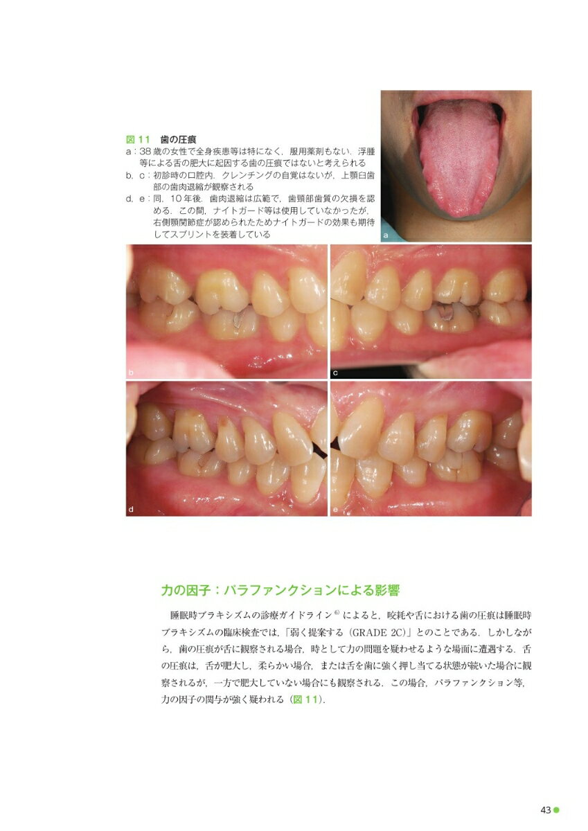 舌の診かた 舌の状態から全身疾患や体の歪みに気づく [ 小山 浩一郎 ] 3