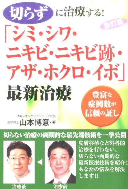 切らずに治療する！「シミ・シワ・ニキビ・ニキビ跡・アザ・ホクロ・イボ」最新治療新訂版