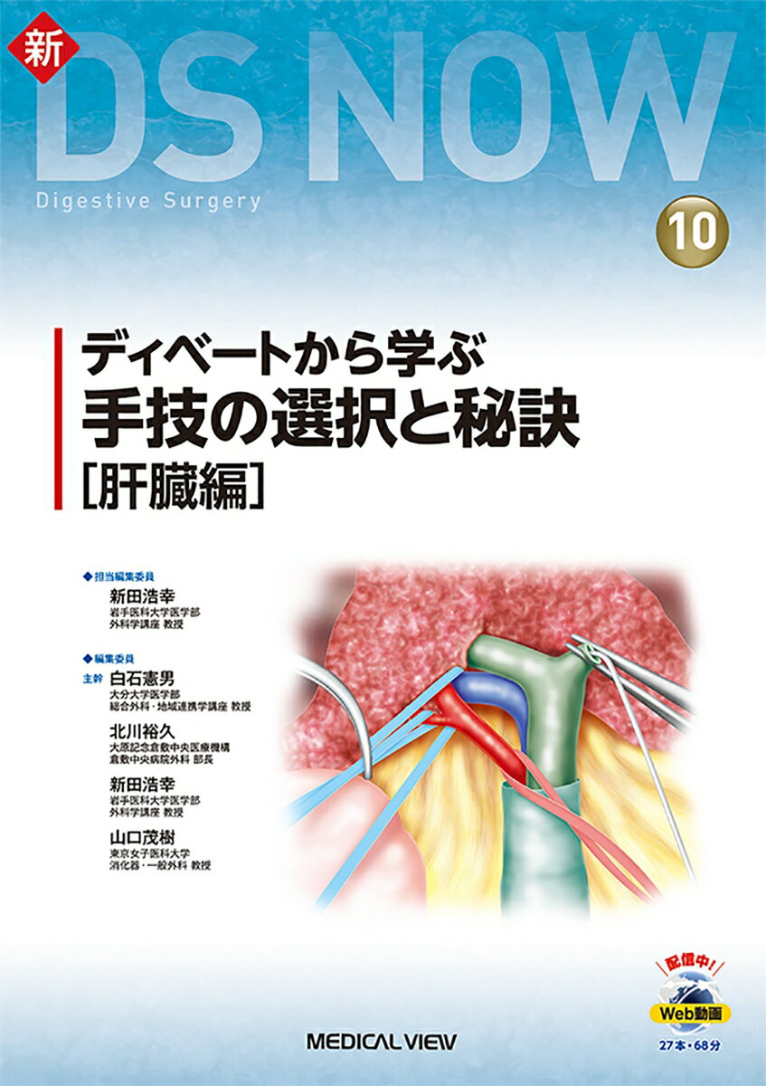 ディベートから学ぶ 手技の選択と秘訣［肝臓編］