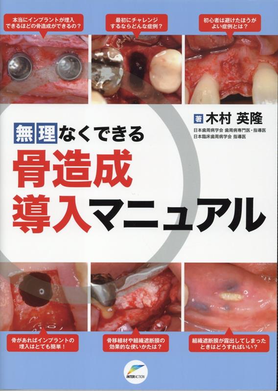 無理なくできる骨造成導入マニュアル [ 木村英隆 ]