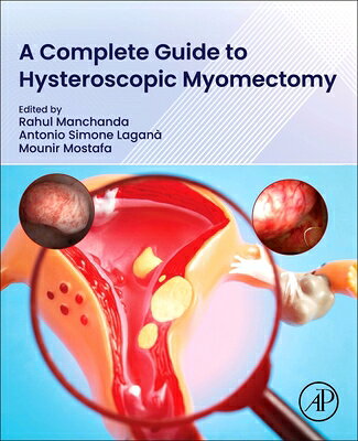 A Complete Guide to Hysteroscopic Myomectomy COMP GT HYSTEROSCOPIC MYOMECTO 