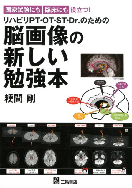 国家試験にも臨床にも役立つ！リハビリPT・OT・ST・Dr．のための脳画像の新しい勉強本 