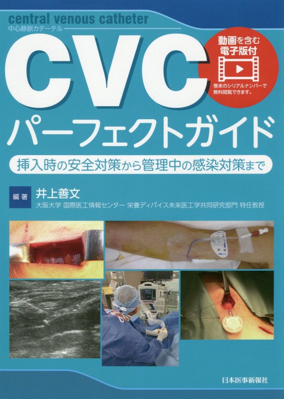 ＣＩＣＣ、ＰＩＣＣ、ＣＶポートの３方式を網羅。動画でじっくり！挿入から管理までを徹底解説。