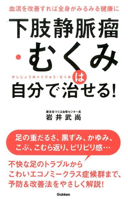 下肢静脈瘤・むくみは自分で治せる！