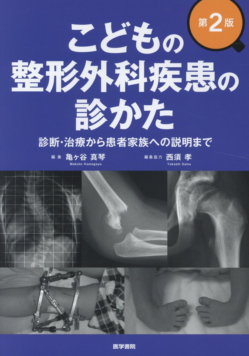 こどもの整形外科疾患の診かた 第2版 診断・治療から患者家族への説明まで [ 亀ヶ谷 真琴 ]