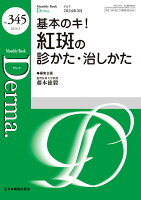 基本のキ！紅斑の診かた・治しかた（2024年3月号No.345）