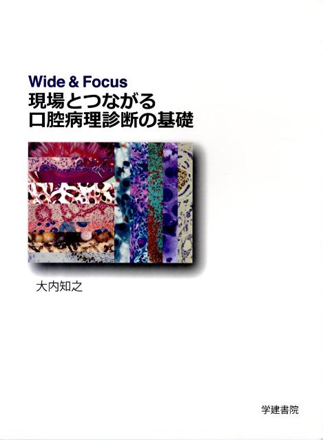 Wide　＆　Focus現場とつながる口腔病理診断の基礎