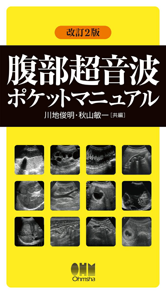 腹部超音波ポケットマニュアル(改訂2版)