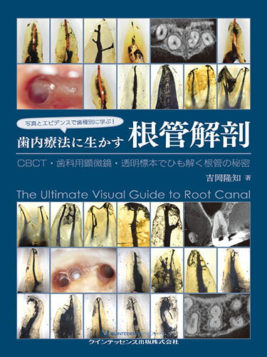 写真とエビデンスで歯種別に学ぶ！ 歯内療法に生かす根管解剖