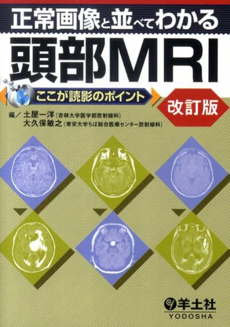 正常画像と並べてわかる頭部MRI改訂版