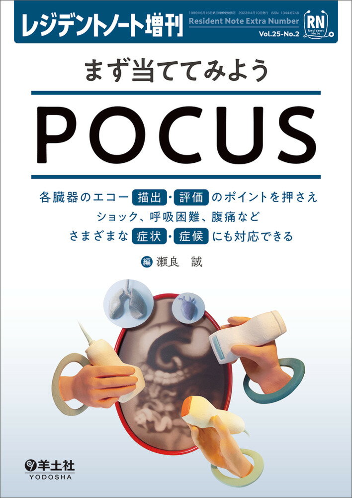 まず当ててみようPOCUS