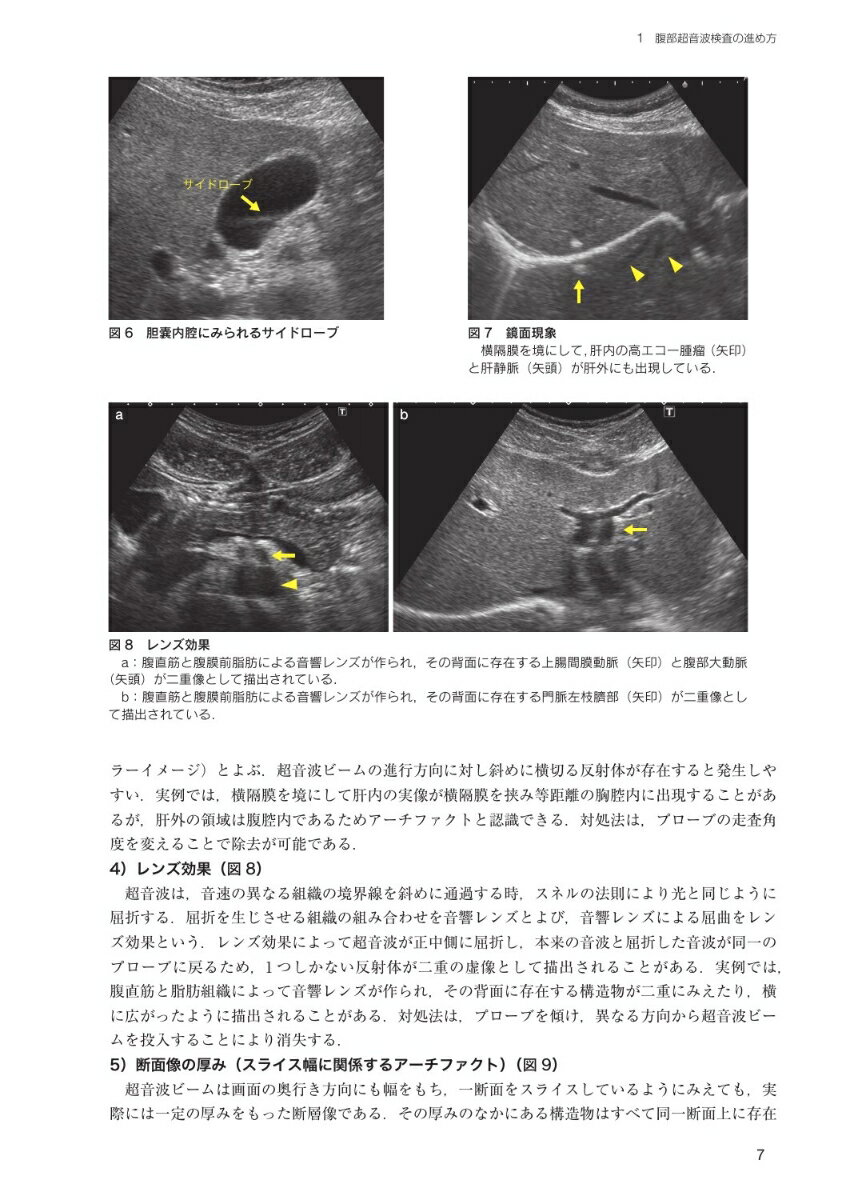 日超検　腹部超音波テキスト第3版 [ 日本超音波検査学会 ] 3