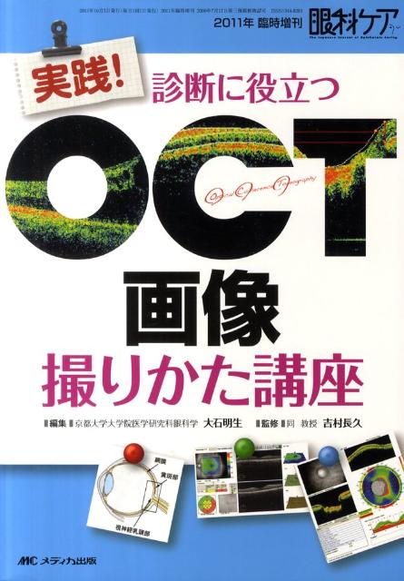 眼科ケア　11年臨時増刊