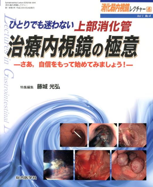 消化器内視鏡レクチャー（1-4） ひとりでも迷わない上部消化管治療内視鏡の極意