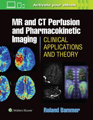 MR and CT Perfusion and Pharmacokinetic Imaging: Clinical Applications and Theoretical Principles MR & CT PERFUSION & PHARMACOKI [ Roland Bammer ]