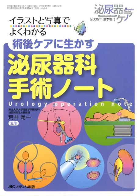 術後ケアに生かす泌尿器科手術ノート