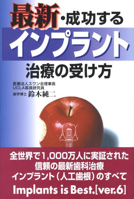 最新・成功するインプラント治療の受け方