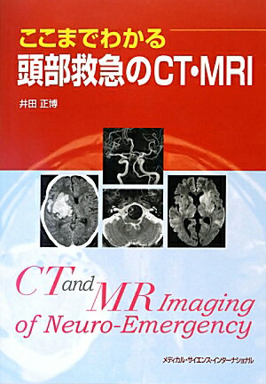 臨場感あふれる解説で、救急画像のプロフェッショナルが間違わない診断のすべてを解き明かす。