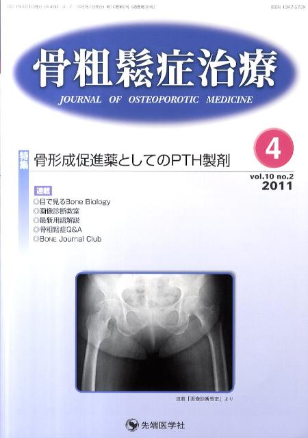 骨粗鬆症治療（10-2）