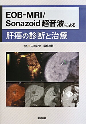 EOB-MRI／Sonazoid超音波による肝癌の診断と治療 [ 工藤正俊 ]