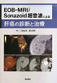 ＭＲＩ造影剤Ｇｄ-ＥＯＢ-ＤＴＰＡと肝小結節の優れた描出能をもつ第二世代超音波造影剤Ｓｏｎａｚｏｉｄのコラボレーションで、肝癌診療の最先端を解き明かす。それぞれの特性と利点・欠点を明確にし、そのうえで融合画像を含めた肝癌のベストな診断に迫る。治療応用においても、肝癌治療のスタンダードとなったＲＦＡとＴＡＣＥの治療効果判定から術中エコーの最先端まで、実践的テクニックとノウハウが満載。