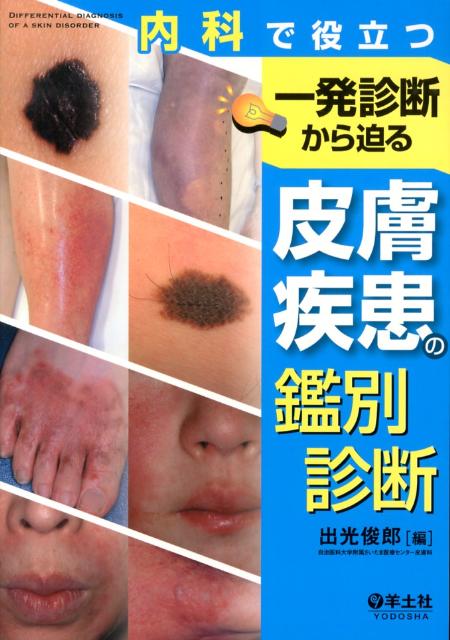 一発診断から迫る皮膚疾患の鑑別診断