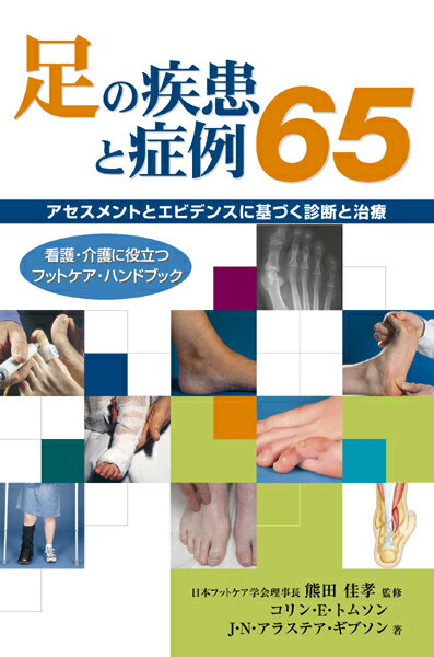 足の診療を行う専門医、一般開業医、看護師、整形外科の研修医、研究する学生、介護師など、足の疾患を持つ患者の症例と管理に携わるすべての人にとって、本書は、日々の診察のきわめて有益なガイドとなるでしょう。