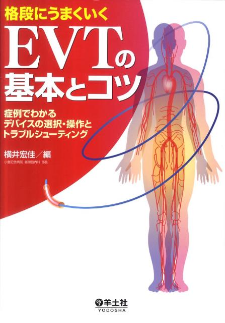 格段にうまくいくEVTの基本とコツ