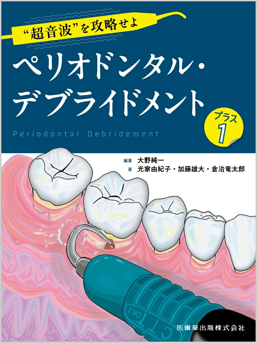 “超音波”を攻略せよ ペリオドンタル・デブライドメント プラス1 [ 大野 純一 ]